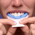 ASD oral appliance